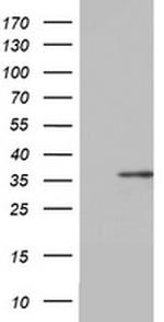 OTC Antibody in Western Blot (WB)