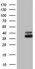 OTC Antibody in Western Blot (WB)