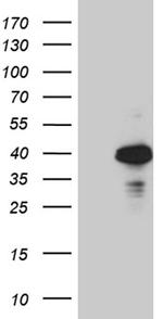 OTC Antibody in Western Blot (WB)