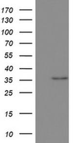 OTC Antibody in Western Blot (WB)