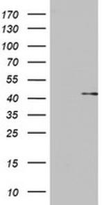 OTC Antibody in Western Blot (WB)
