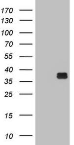OTC Antibody in Western Blot (WB)