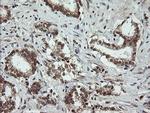 OTUB1 Antibody in Immunohistochemistry (Paraffin) (IHC (P))