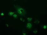 OTUB2 Antibody in Immunocytochemistry (ICC/IF)