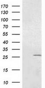 OTUB2 Antibody in Western Blot (WB)