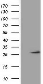 OTUB2 Antibody in Western Blot (WB)