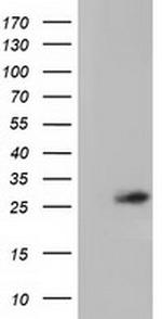 OTUB2 Antibody in Western Blot (WB)