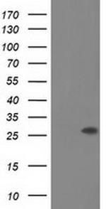 OTUB2 Antibody in Western Blot (WB)