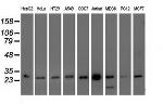 OTUB2 Antibody in Western Blot (WB)