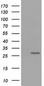 OTUB2 Antibody in Western Blot (WB)