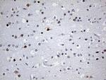 OTX2 Antibody in Immunohistochemistry (Paraffin) (IHC (P))