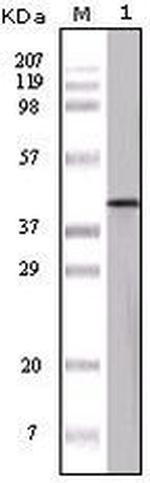 Ovalbumin Monoclonal Antibody (3G2E1D9,3D5F4A8,3G1E1D9)