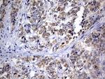 OXSM Antibody in Immunohistochemistry (Paraffin) (IHC (P))