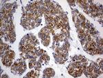 OXSM Antibody in Immunohistochemistry (Paraffin) (IHC (P))