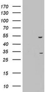 OXSM Antibody in Western Blot (WB)