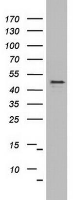 OXSM Antibody in Western Blot (WB)