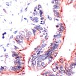 Occludin Antibody in Immunohistochemistry (IHC)