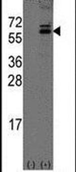 OLFM1 Antibody in Western Blot (WB)