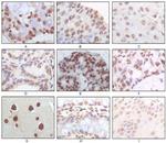p16INK4a Monoclonal Antibody (3G8D12)