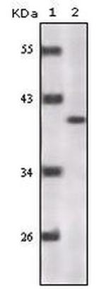 p16INK4a Antibody in Western Blot (WB)