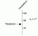 Peripherin Antibody in Western Blot (WB)