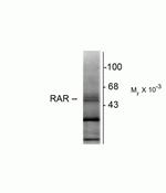 RARB Antibody in Western Blot (WB)