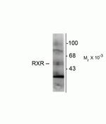 RXRG Antibody in Western Blot (WB)