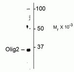 OLIG2 Polyclonal Antibody