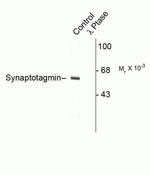 Phospho-Synaptotagmin 1 (Thr202) Polyclonal Antibody