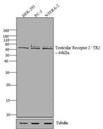 TR2 Antibody in Western Blot (WB)