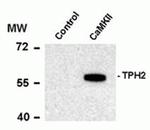 Phospho-TPH2 (Ser19) Antibody in Western Blot (WB)