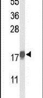 p21 Antibody in Western Blot (WB)