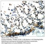 GTPase HRAS Antibody in Immunohistochemistry (IHC)