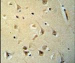 PPP2R3C Antibody in Immunohistochemistry (IHC)