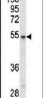 PPP2R3C Antibody in Western Blot (WB)