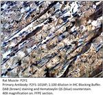 P2Y1 Polyclonal Antibody