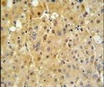 Cytochrome P450 Reductase Antibody in Immunohistochemistry (IHC)