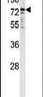 Cytochrome P450 Reductase Antibody in Western Blot (WB)