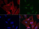 P53 Antibody in Immunocytochemistry (ICC/IF)
