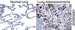 P53 Antibody in Immunohistochemistry (Paraffin) (IHC (P))