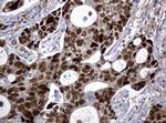P53 Antibody in Immunohistochemistry (Paraffin) (IHC (P))