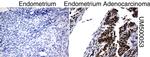 P53 Antibody in Immunohistochemistry (Paraffin) (IHC (P))