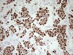 P53 Antibody in Immunohistochemistry (Paraffin) (IHC (P))