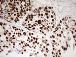 P53 Antibody in Immunohistochemistry (Paraffin) (IHC (P))