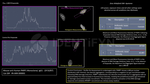 PARP1 Antibody in Immunocytochemistry (ICC/IF)