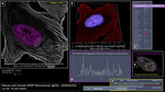 ATRIP Antibody in Immunocytochemistry (ICC/IF)