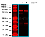ATRIP Antibody in Western Blot (WB)