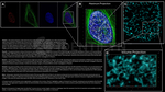 Ku70 Antibody in Immunocytochemistry (ICC/IF)
