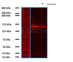 RAD50 Antibody in Western Blot (WB)