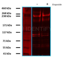 53BP1 Antibody in Western Blot (WB)